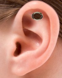 Dermal Punch Piercing