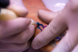 Tattoo Scabbing and Peeling